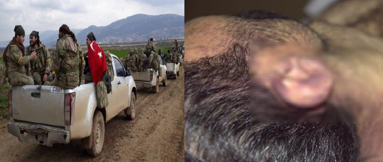 Afrin’de ÖSO tarafından işkenceye maruz kalan Kürt vatandaş hayatını kaybetti