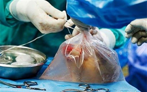 İran rejimi Corona kurbanlarının organlarını çalıyor