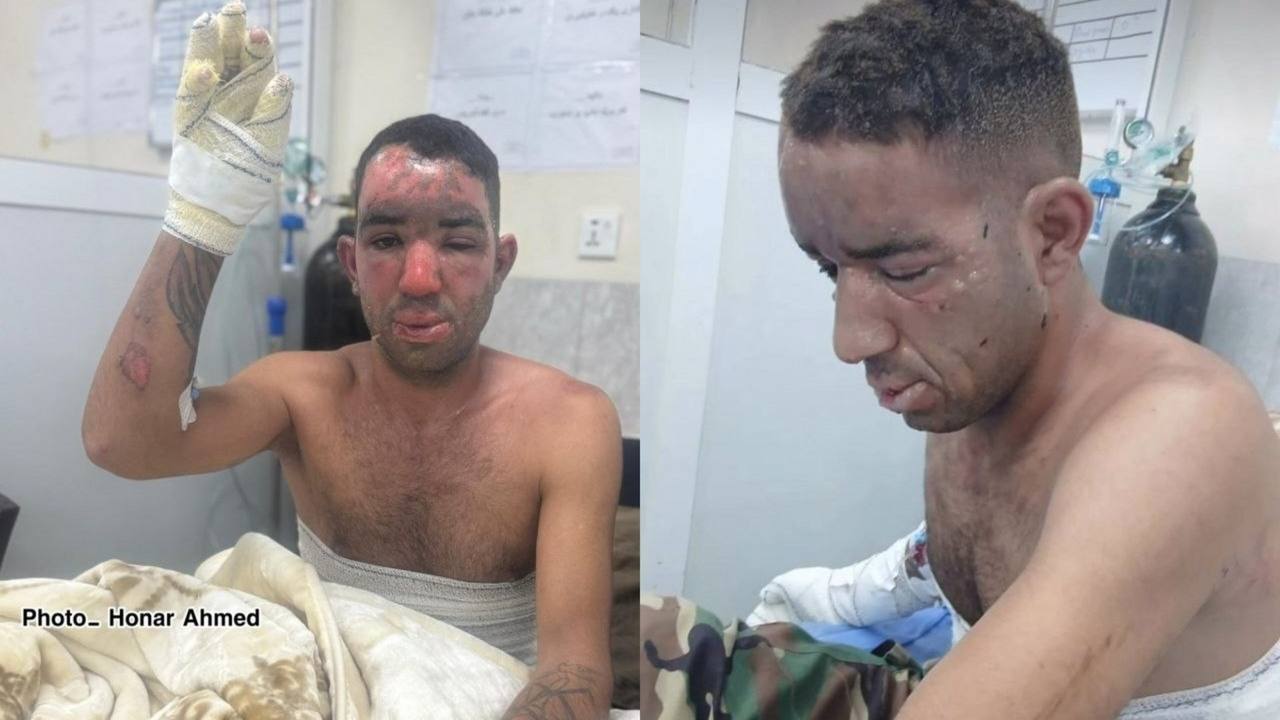بەکارهێنانی فۆسفۆری سپی لە هێرشە دڕۆنییەکەی ئێران بۆ سەر پارتی ئازادیی کوردستان