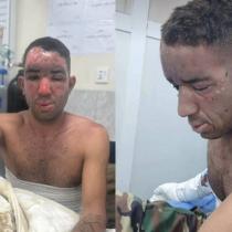 بەکارهێنانی فۆسفۆری سپی لە هێرشە دڕۆنییەکەی ئێران بۆ سەر پارتی ئازادیی کوردستان