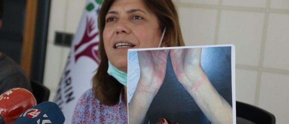 HDP: Türk polisi, HDP yetkilisi Rojbin Çetin’e köpekleri saldırtarak işkence etti