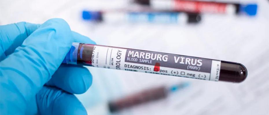 فيروس ماربورغ