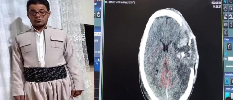 پزشکان داوطلب کوردستان تصاویری از ضایعه مغزی فردین جعفری را منتشر کردند