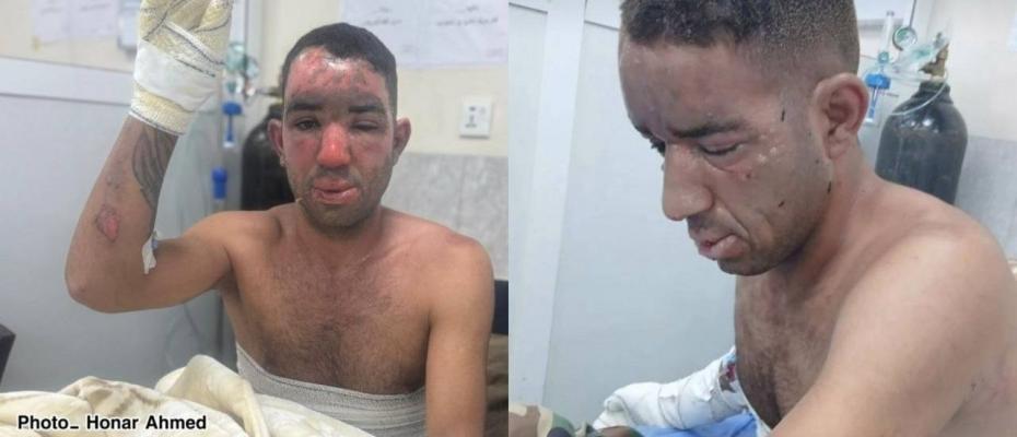 بەکارهێنانی فۆسفۆری سپی لە هێرشە دڕۆنییەکەی ئێران بۆ سەر پارتی ئازادیی کوردستان